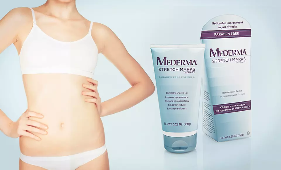 $21.99 for a 5.29 Oz. Box of Mederma Stretch Marks Therapy Cream ($39.99 List Price). Free Shipping. - Primary Image
