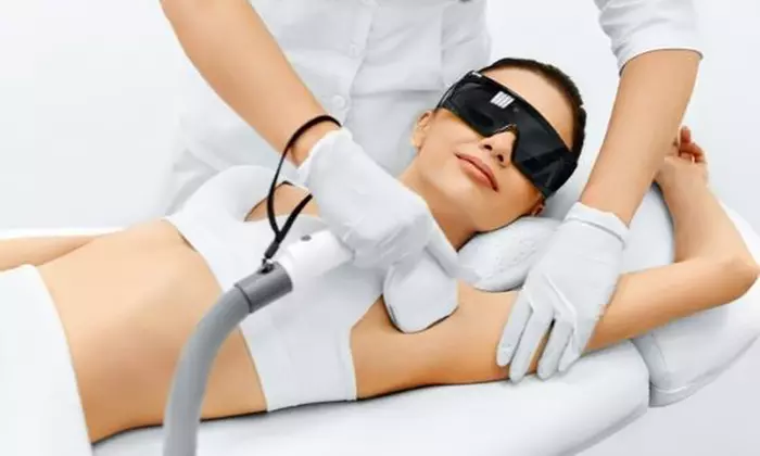 ¡Adiós al vello! Depilación con láser diodo en Levi Estética Avanzada