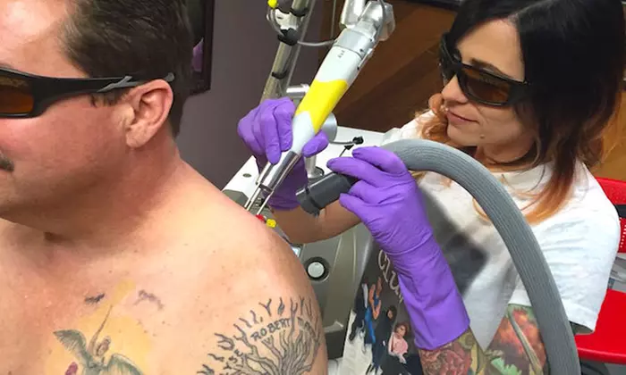One or Two Laser Tattoo Removal Sessions of Up to 10 Square Inches Each at Area 51 Tattoo (Up to 72% Off)  - Primary Image
