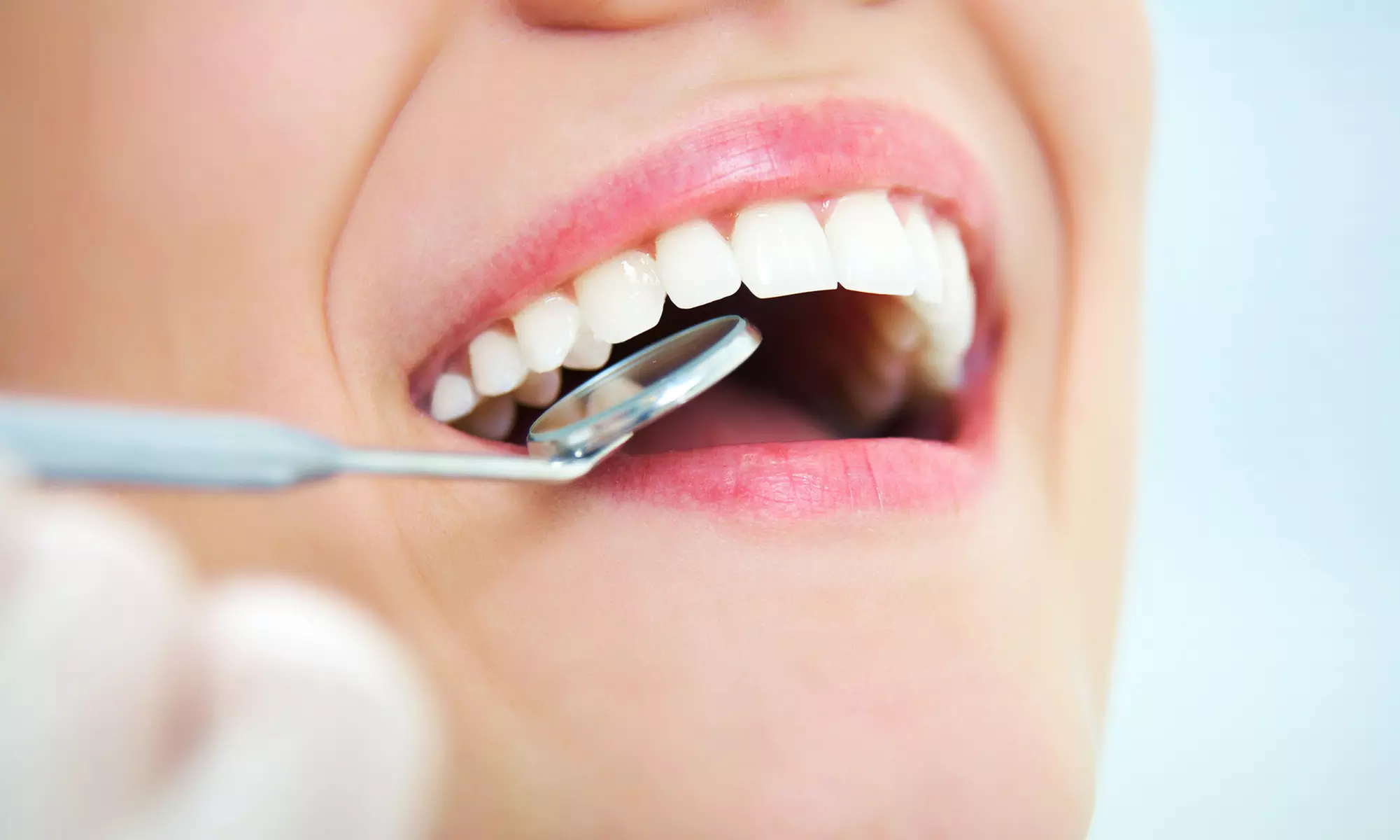 Choice of Dental Treatment at Veneers Dental Center - Primary Image