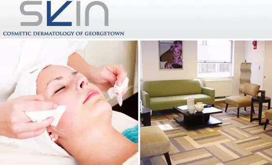 $85 for Facial Peel from One of DC's Best ($200 Value) - Primary Image