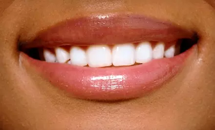 $125 for Zoom! Teeth-Whitening Treatment at The Smile Design Center of Dr. Myron Kellner in Lutherville ($400 Value) - Primary Image