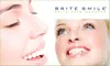 $185 for Teeth Whitening at BriteSmile (Normally $600)