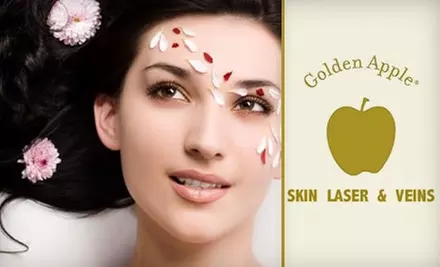 $99 for Laser Vein Treatment at Golden Apple Skin Laser & Veins in Goodyear - Primary Image