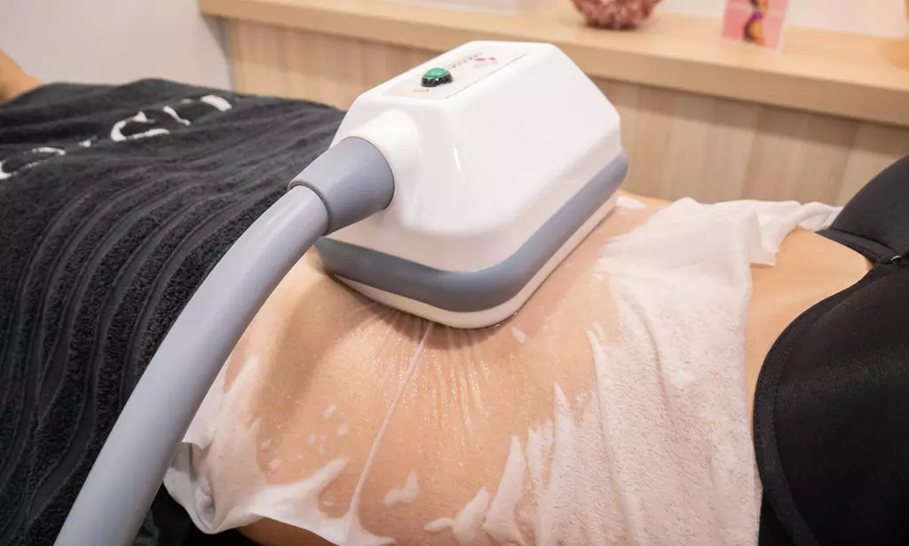 1 o 2 sesiones de criolipolisis en la Clínica Láser Fusión Raimundo