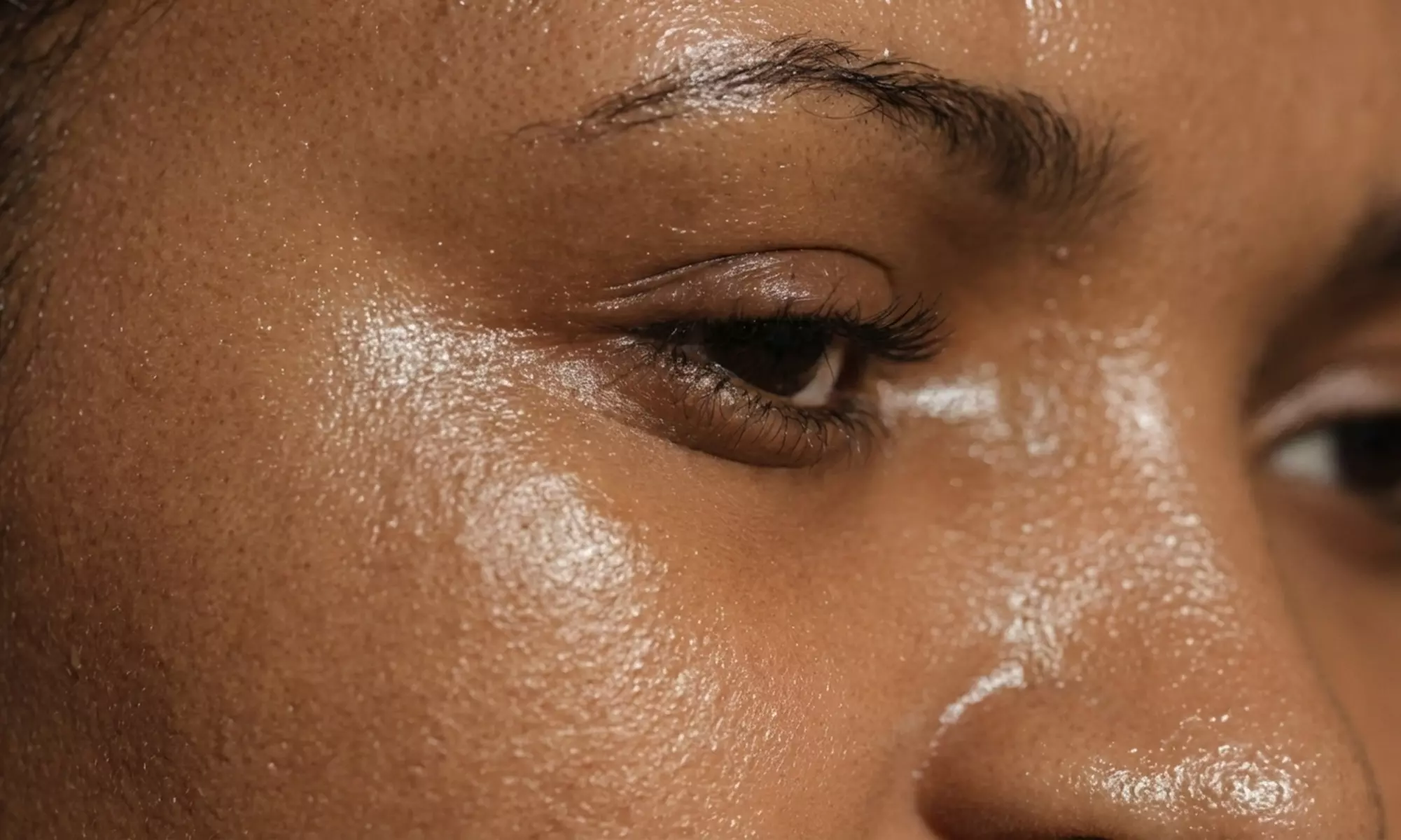 20 or 40 Unit Botox Treatments for Smoother Refreshed Look