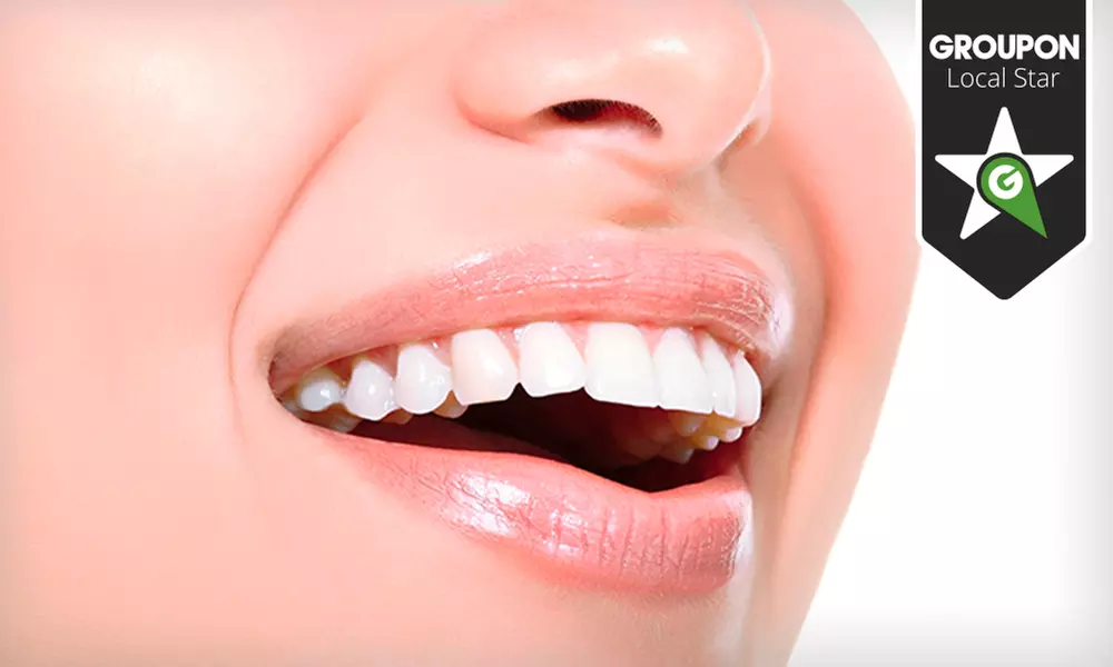 Higiene bucal por 19,90 € y con limpieza profunda de encías por 79,90 € en Santander, Corrales y Gijón - Primary Image