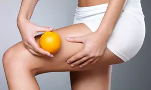 Cellulite-Behandlung oder Bandagen-Körperbehandlung bei Vilona Beauty ab 24,90 € (bis zu 59% sparen*)