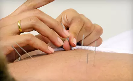 One or Two Acupuncture Sessions from Ellen Ona, L.Ac., in Castle Shannon (Up to 57% Off) - Primary Image