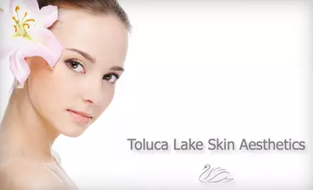 $55 for One Ultra Peel 1 Treatment at Toluca Lake Skin Aesthetics in Burbank ($120 Value) - Primary Image