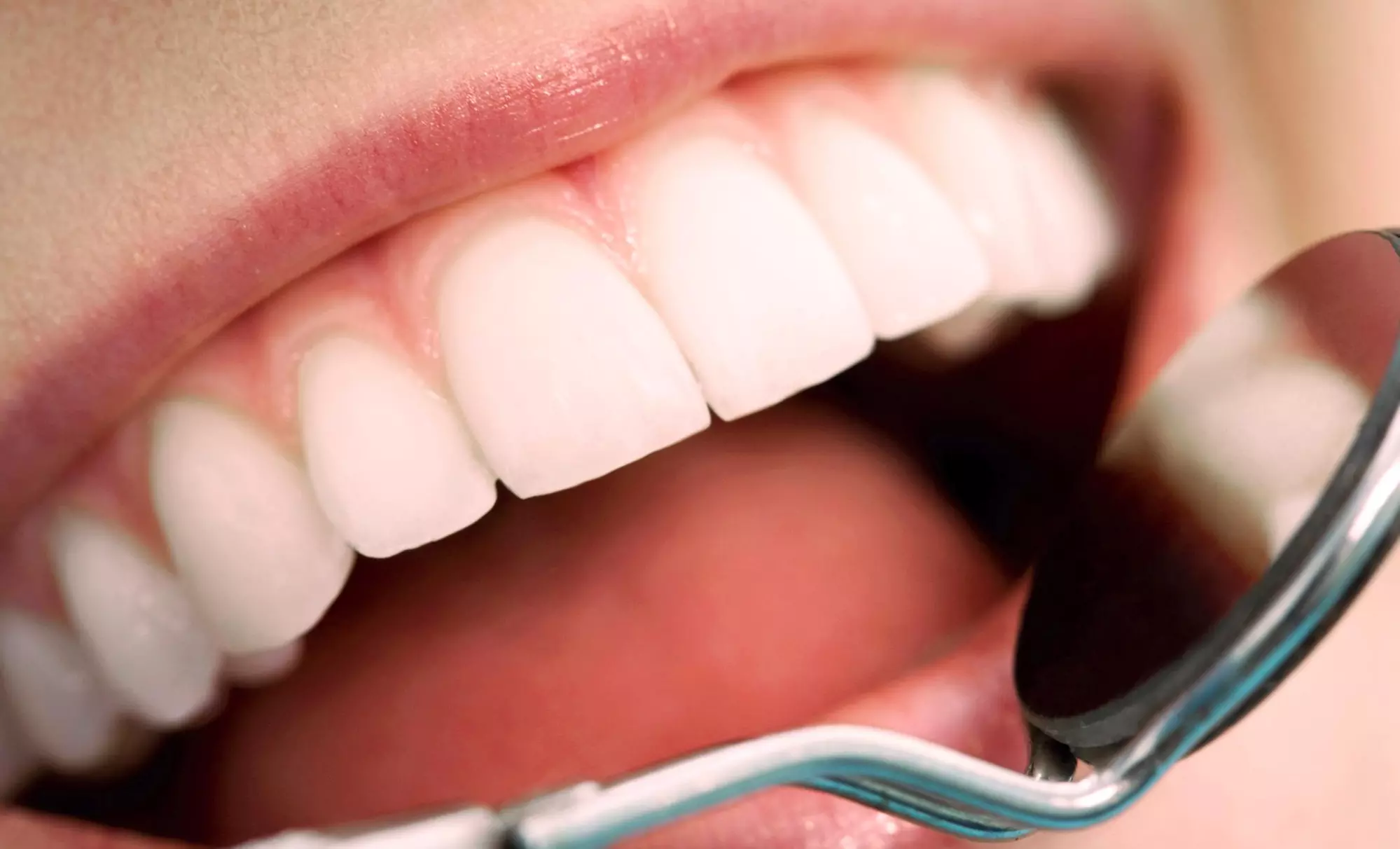 $141 Off Full Comprehensive Dental Exam and X-Rays at New England Dental Group - Primary Image