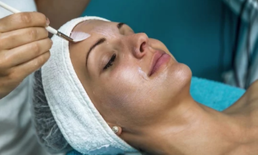 Image 3: One Chemical Peel at Sugarlime Wax and Sugaring Studio