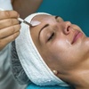 Image 3: One Chemical Peel at Sugarlime Wax and Sugaring Studio