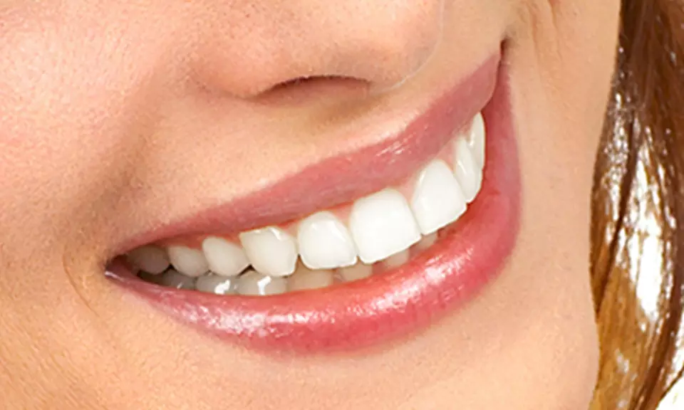 Limpieza bucal y férula de descarga rígida por 89,95 € - Primary Image