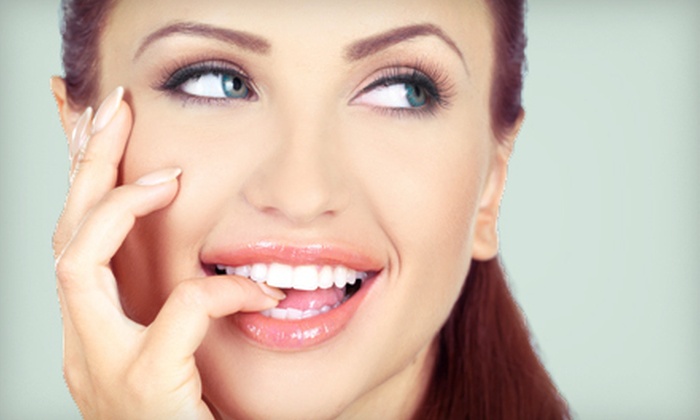 San Diego S Teeth Whitening Center In San Diego Ca Groupon