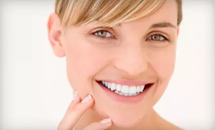 $89 for Laser-Light Teeth Whitening at Planet Tan in Clearwater ($279.95 Value) - Primary Image