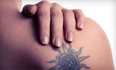 Three Laser Tattoo-Removal Treatments for a 2"x2" or 4"x4" Tattoo at Prescription 2 Fitness (Up to 89% Off) - Primary Image