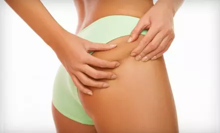 $400 for Four Lipo-Ex Treatments at Beautiful You (Up to $1,200 Value) - Primary Image