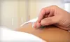 One or Two 60-Minute Acupuncture Sessions at Tigerlily Wellness & Acupuncture (Up to 76% Off)