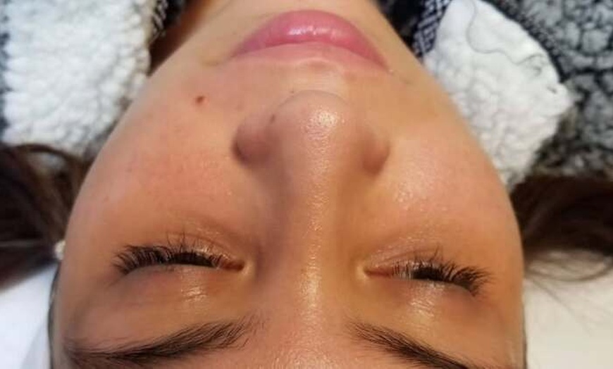 Image 3: Achieve Radiant Skin with Elite Pro Wellness' Personalized Facials up to 55% Off