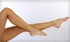 $150 for a Sclerotherapy Spider-Vein Treatment at Calcagno and Rossi Vein Treatment Center in Mechanicsburg ($350 Value)