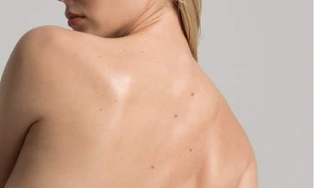 60- Minute Carboxy CO2 therapy Back - Beauty Line