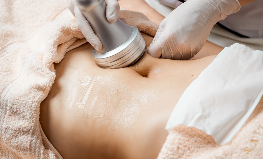 Image 6: Transform Your Body with CoolSculpting Elite Sessions