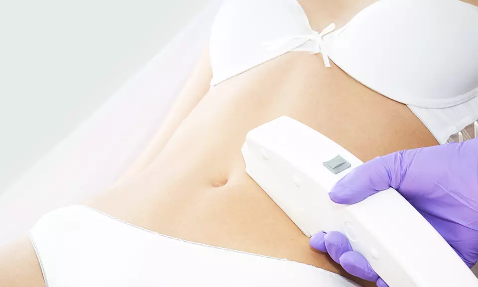  6 Intense Pulsed Light Sessions - Small, Medium, Large or XL Areas