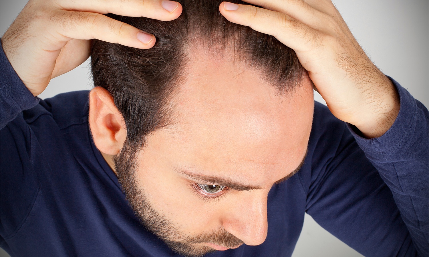 Expert micropigmentation for full head or spot treatments