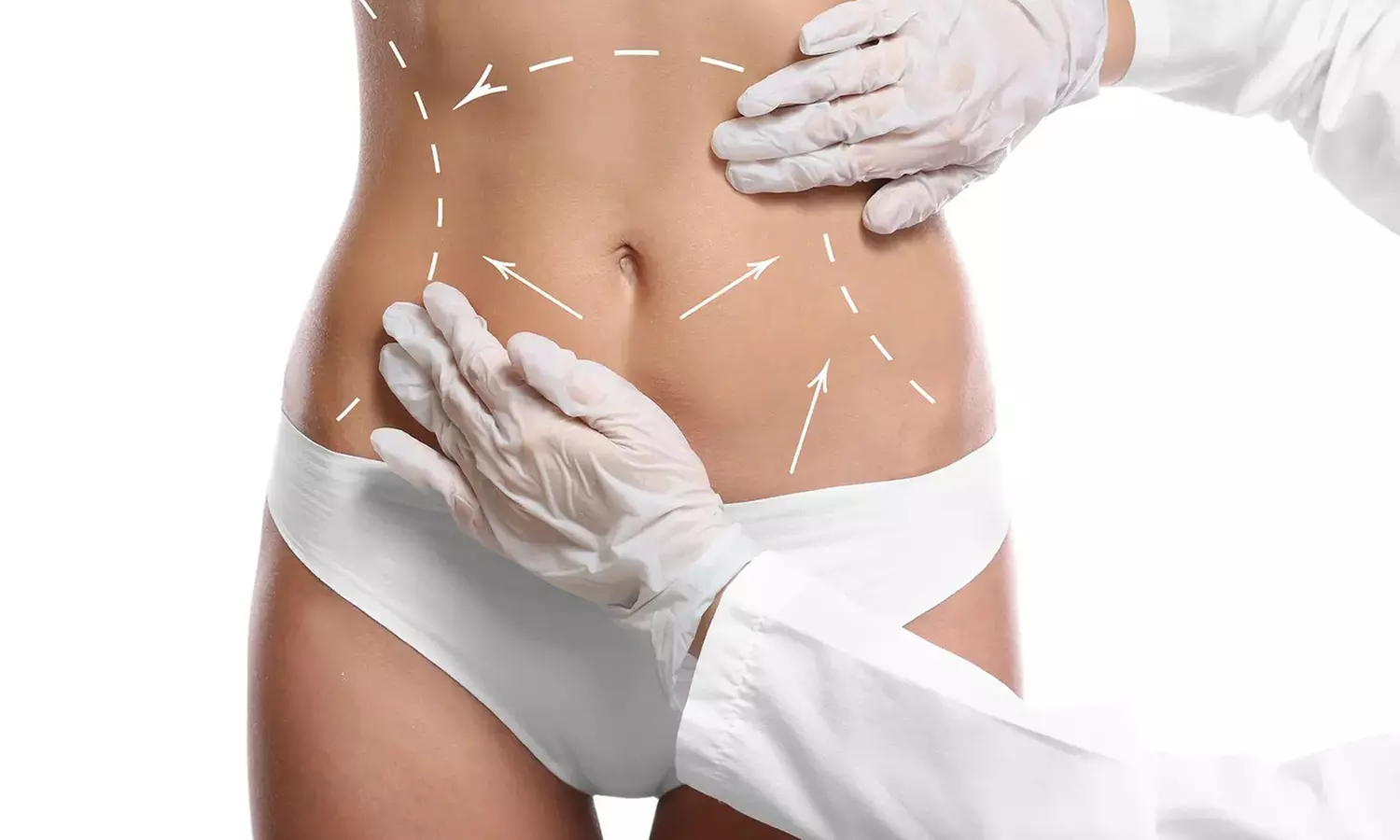 Bodyology BodySculpt offers tailored post-op care with up to 15% off, choose between five or ten personalized sessions - Primary Image