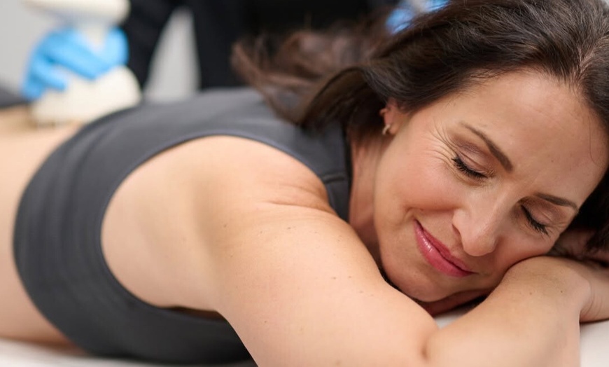 Image 1: One or Three Venus Legacy RF Skin Tightening Treatments