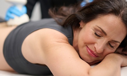 One Venus Legacy RF Skin Tightening Treatment - LightRx