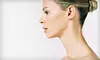 $149 for ProFractional Laser Neck Treatment at Luminescence ($350 Value)