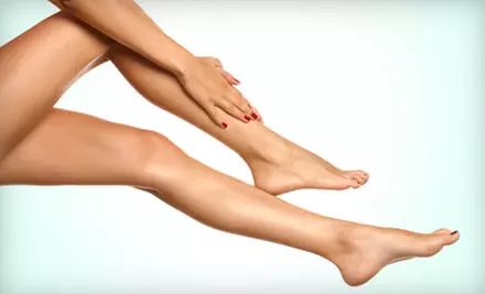 Spider Vein Treatment Package at Crown Medical. Three Locations Available. - Primary Image