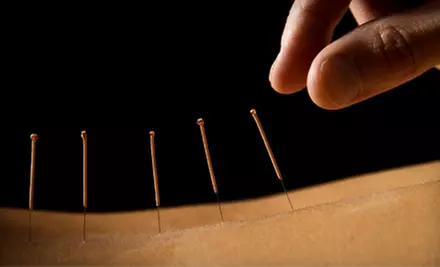 One, Three, or Five Acupuncture Sessions at Carolina Health Innovations (Up to 51% Off) - Primary Image