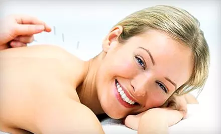 $55 for Acupuncture Treatment at A Way of Life Acupuncture in Ponte Vedra Beach ($140 Value) - Primary Image