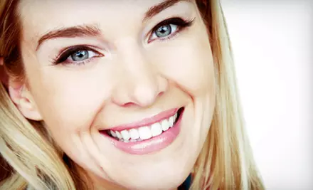One or Two Blue-LED Teeth-Whitening Treatments at White Smile BC (Up to 59% Off) - Primary Image
