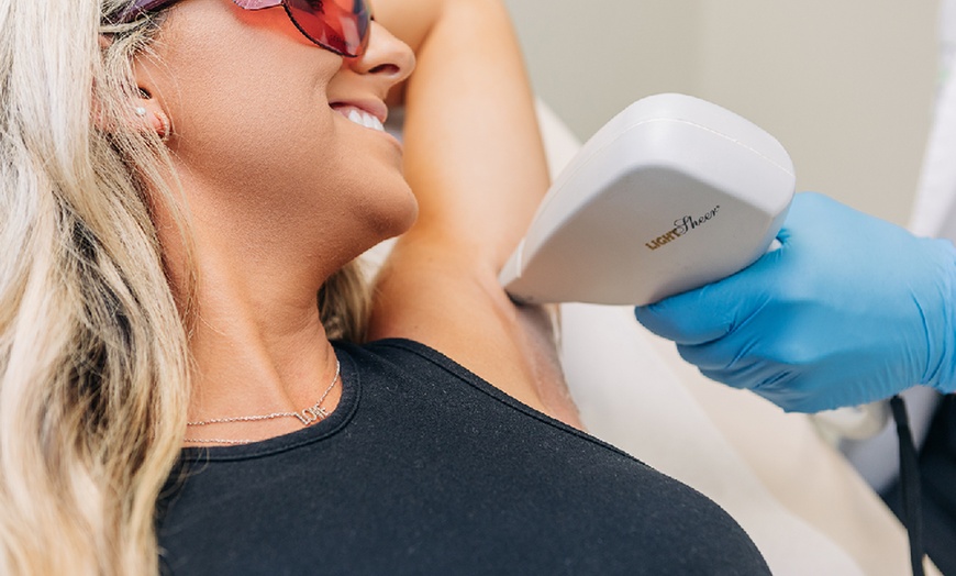 Image 1: Laser Hair Removal for Smooth Skin: Small, Medium, or Large Area