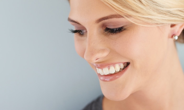 Blanqueamiento y limpieza bucal hasta -83%