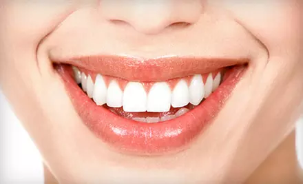 Four, Six, or Eight Porcelain Veneers at University Dental Care in University City  - Primary Image
