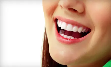 Zoom! Whitening or Dental Package with Basic Cleaning, Exam, and X-rays at Smiles West (Up to 93% Off) - Primary Image