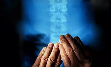 $15 for a 30-Minute Hydro-Table Massage and Spine Analysis at Mid-America Spine & Rehab in Des Peres (Up to $88 Value) - Primary Image