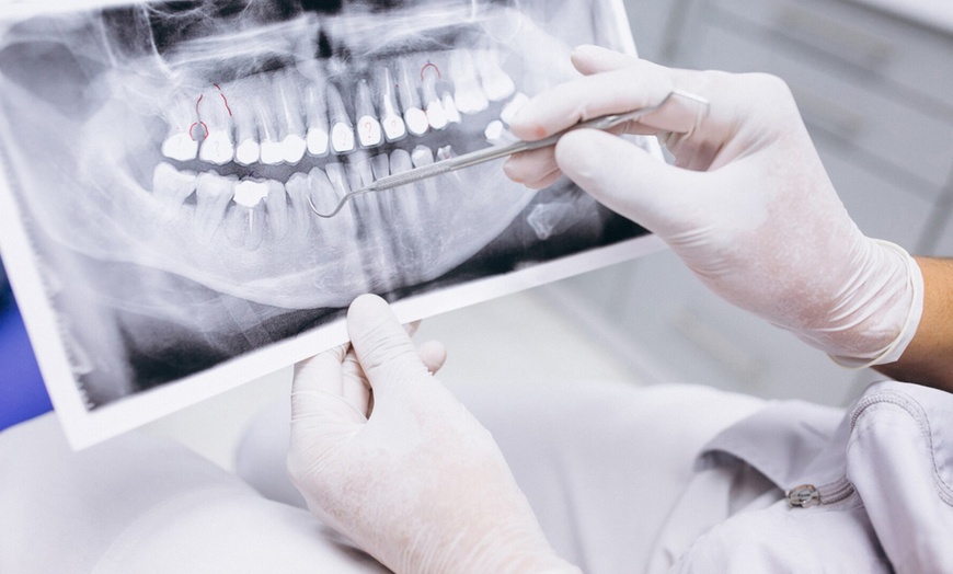 Image 5: Higiene dental completa y opción a curetaje de encías en 1 o 2 arcadas