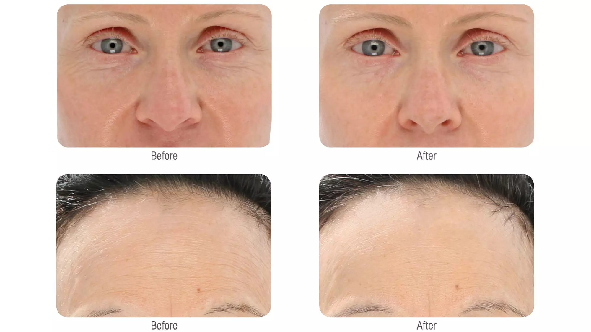 Couples Massage with Foot Bath or Rejuvenating Red Light Therapy