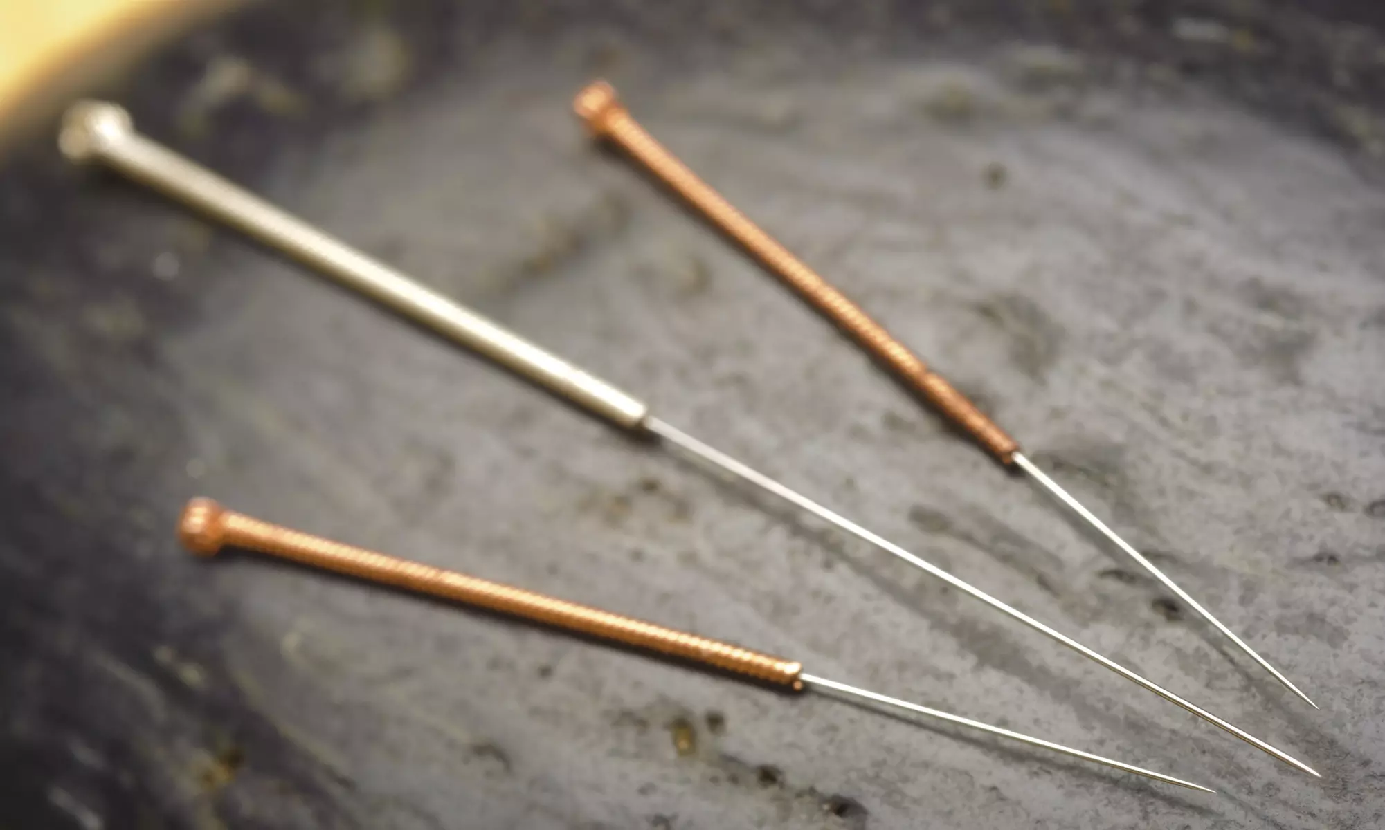 An Acupuncture Treatment and an Initial Consultation at 1000 folded cranes acupuncture clinic (69% Off) - Primary Image