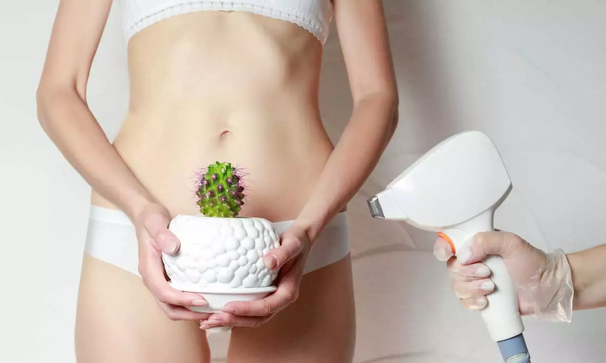 Séances d'épilation au laser maillot classique chez Sellou-Sweet