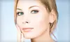 VI Peel or Microdermabrasion at Timeless Laser Rejuvenation Center in Kissimmee 