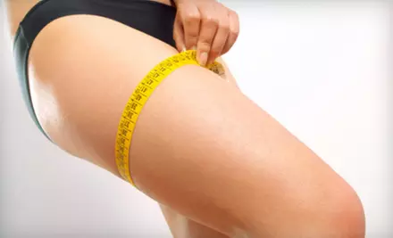 3, 6, or 10 Ultrasound Cavitation Fat- and Cellulite-Reduction Treatments at Northshore Medical Center in Buffalo Grove (Up to 70% Off) - Primary Image