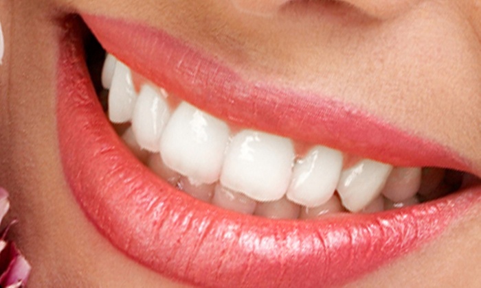 Blanqueamiento LED+limpieza bucal