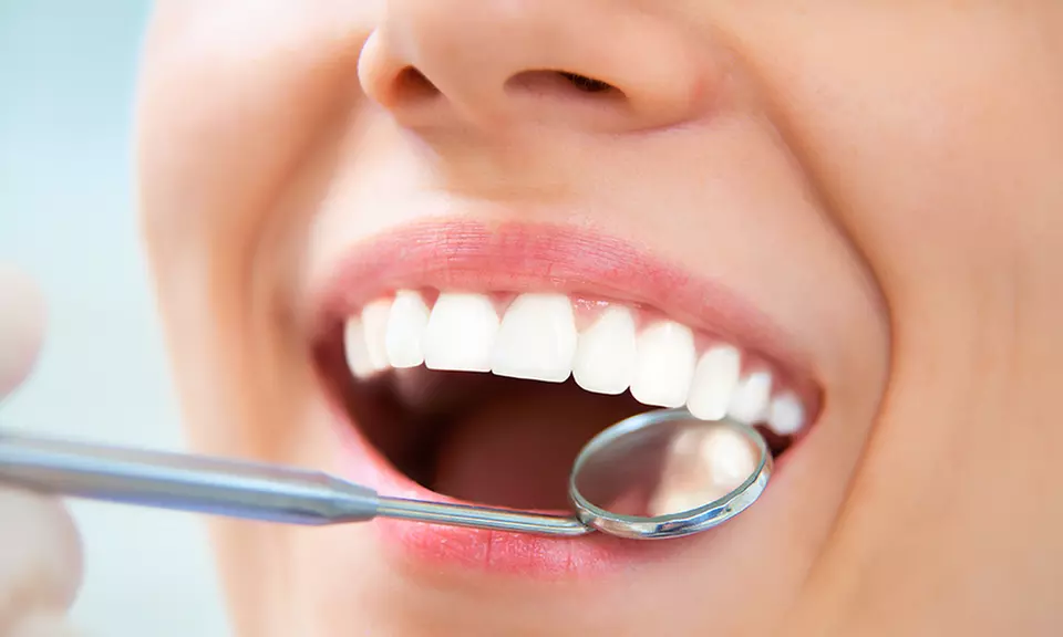 Brackets metálicos, de porcelana o de zafiro en 2 arcadas con 6 revisiones para una persona desde 259 € en Improdent - Primary Image